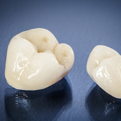 A closeup of two ceramic dental crowns