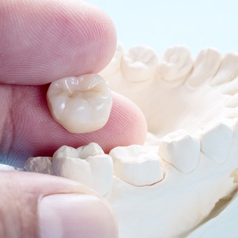 A hand holding up a dental crown in front of a mock jaw